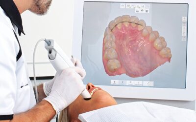 Qual a função do escaneamento intraoral no seu tratamento com aparelhos transparentes?